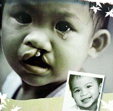 Ảnh[-]minh[-]họa